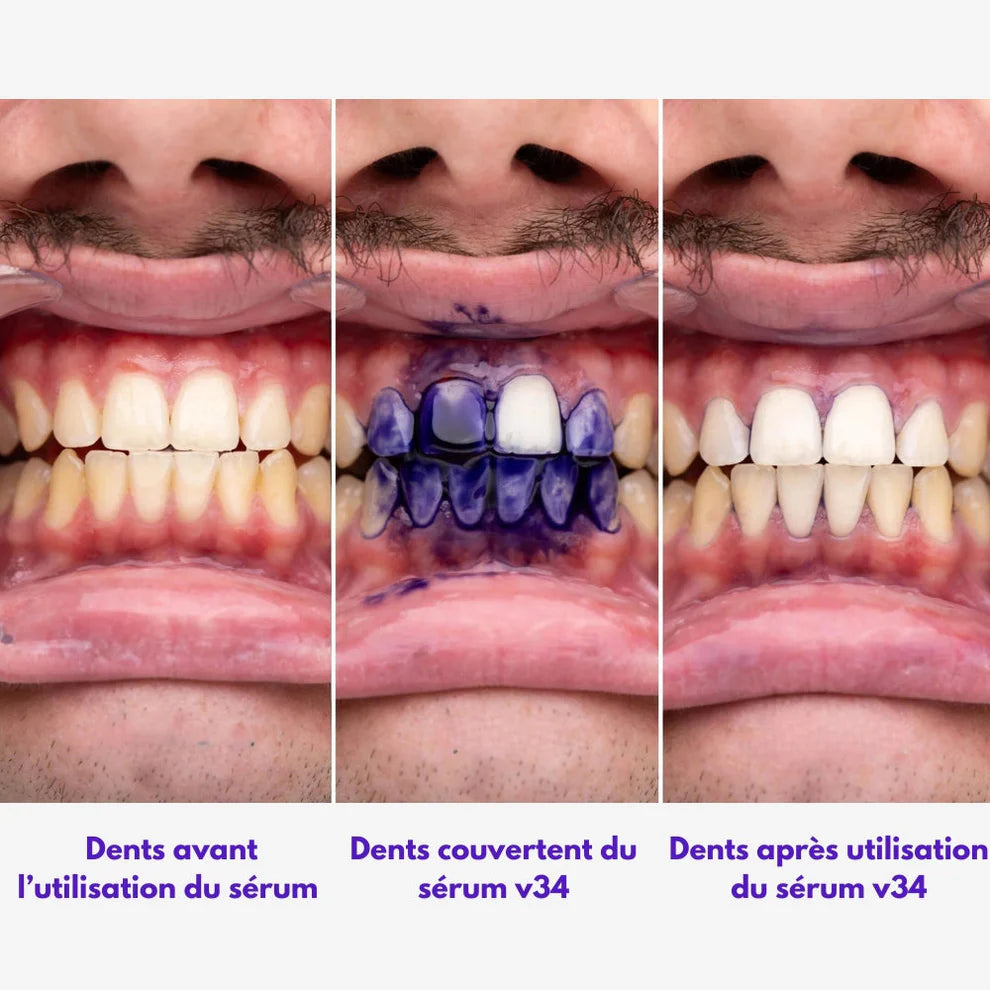 Dentifrice blanchissant violet